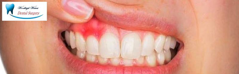 Natural Things That Help To Get Rid Of Common Dental Problems