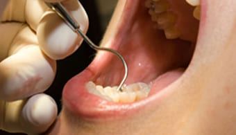 preventive-dentistry-Dental-Clinic-Berwick