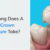 How Long Does a Dental Crown Take?