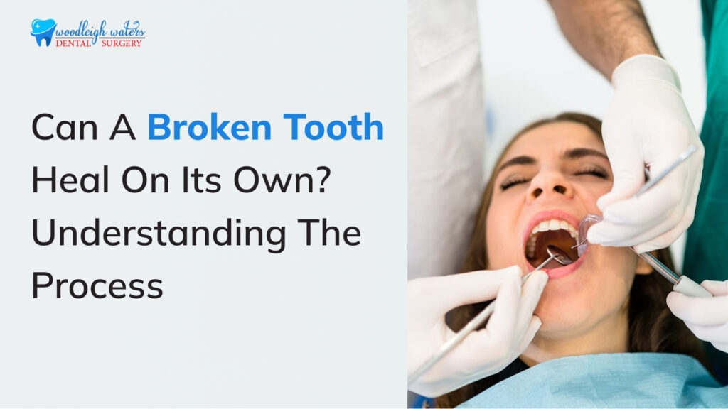 Can a Broken Tooth Heal on Its Own? Learn More Here